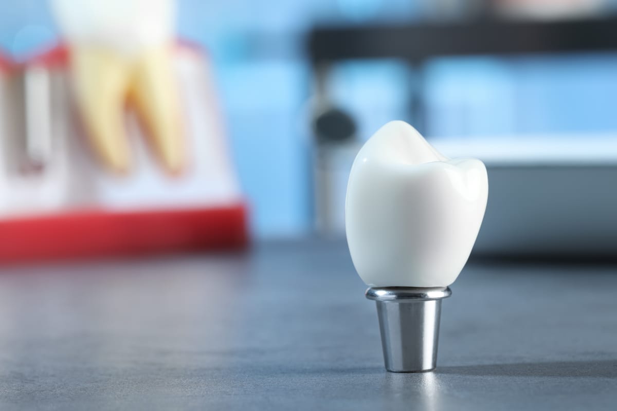 Restorative Dentistry in Williams Lake